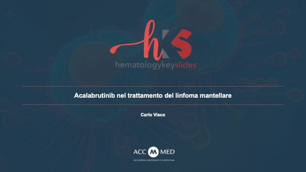 Acalabrutinib nel trattamento del linfoma mantellare